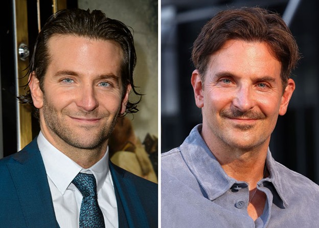 Bradley Cooper — young vs older photo showing how upper lid surgery can elongate the lash-to-crease distance in men