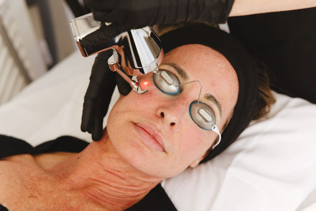 Laser scar treatment with ProFractional and BBL at Treasure Valley Medical Spa in Meridian, Idaho