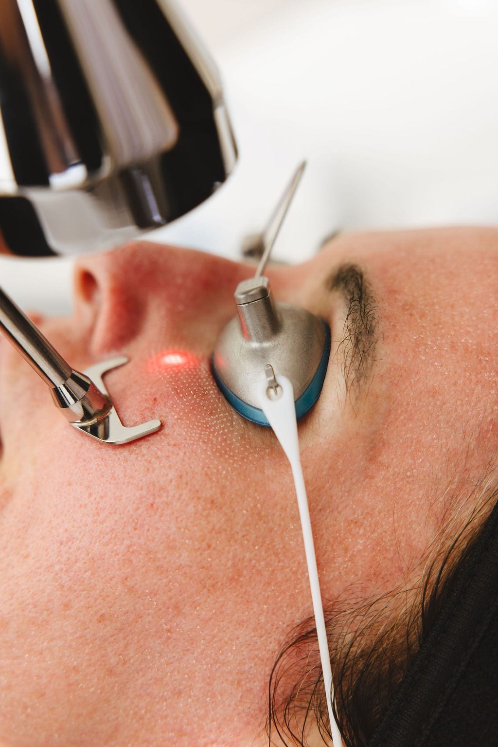 Laser treatment close-up
