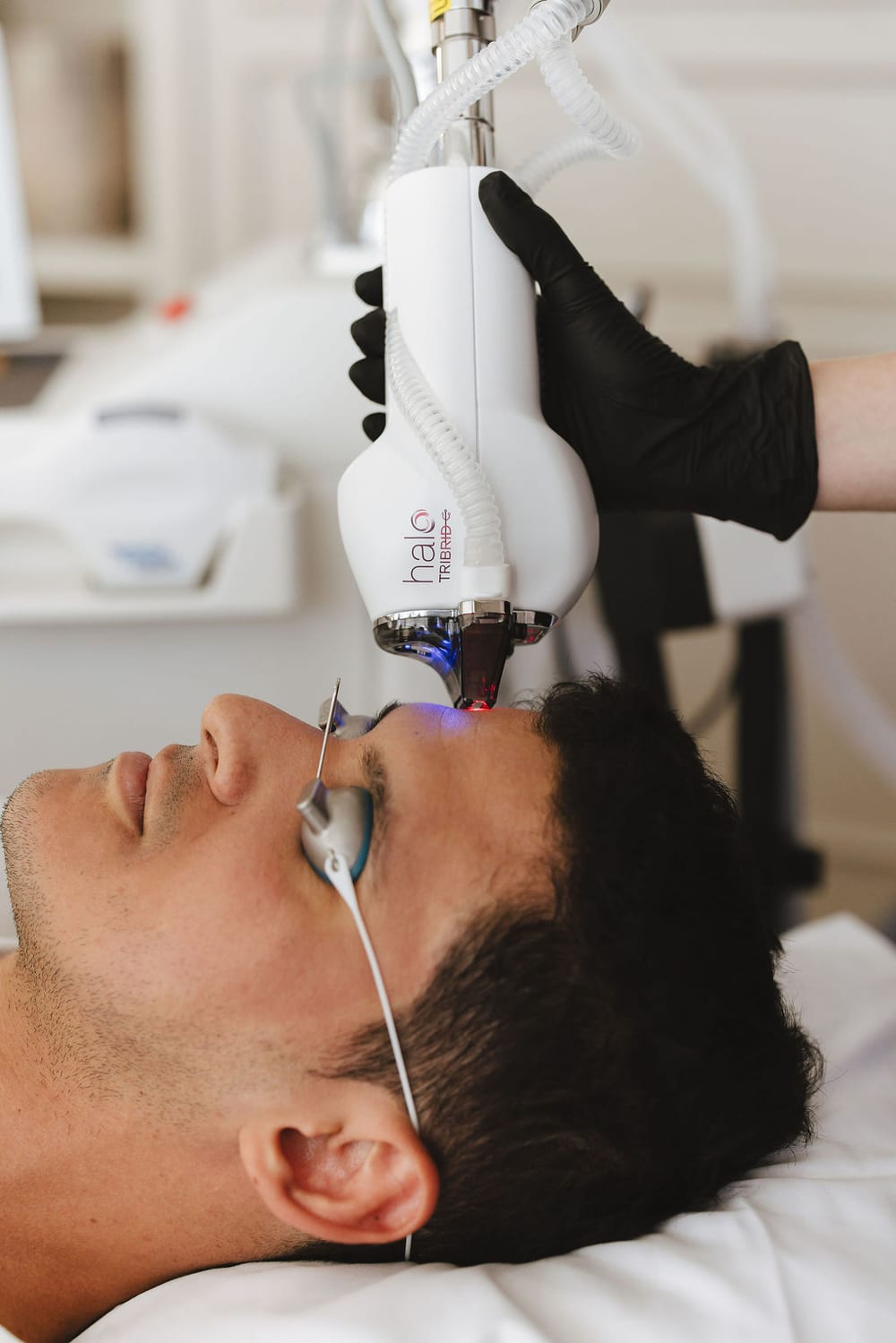 Male patient receiving HALO TRIBRID laser treatment