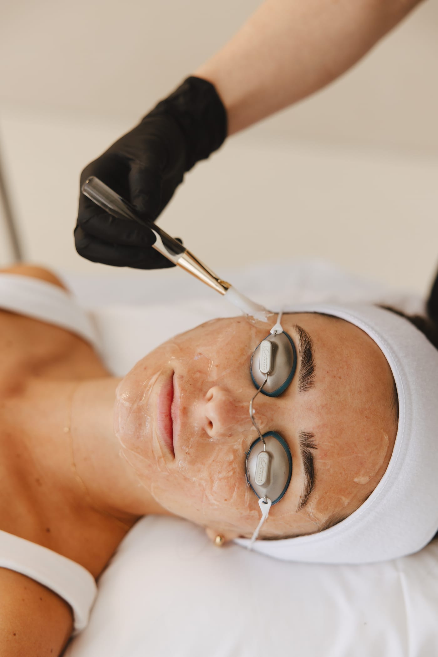 Patient receiving BBL HEROic treatment with protective eye shields at Treasure Valley Medical Spa