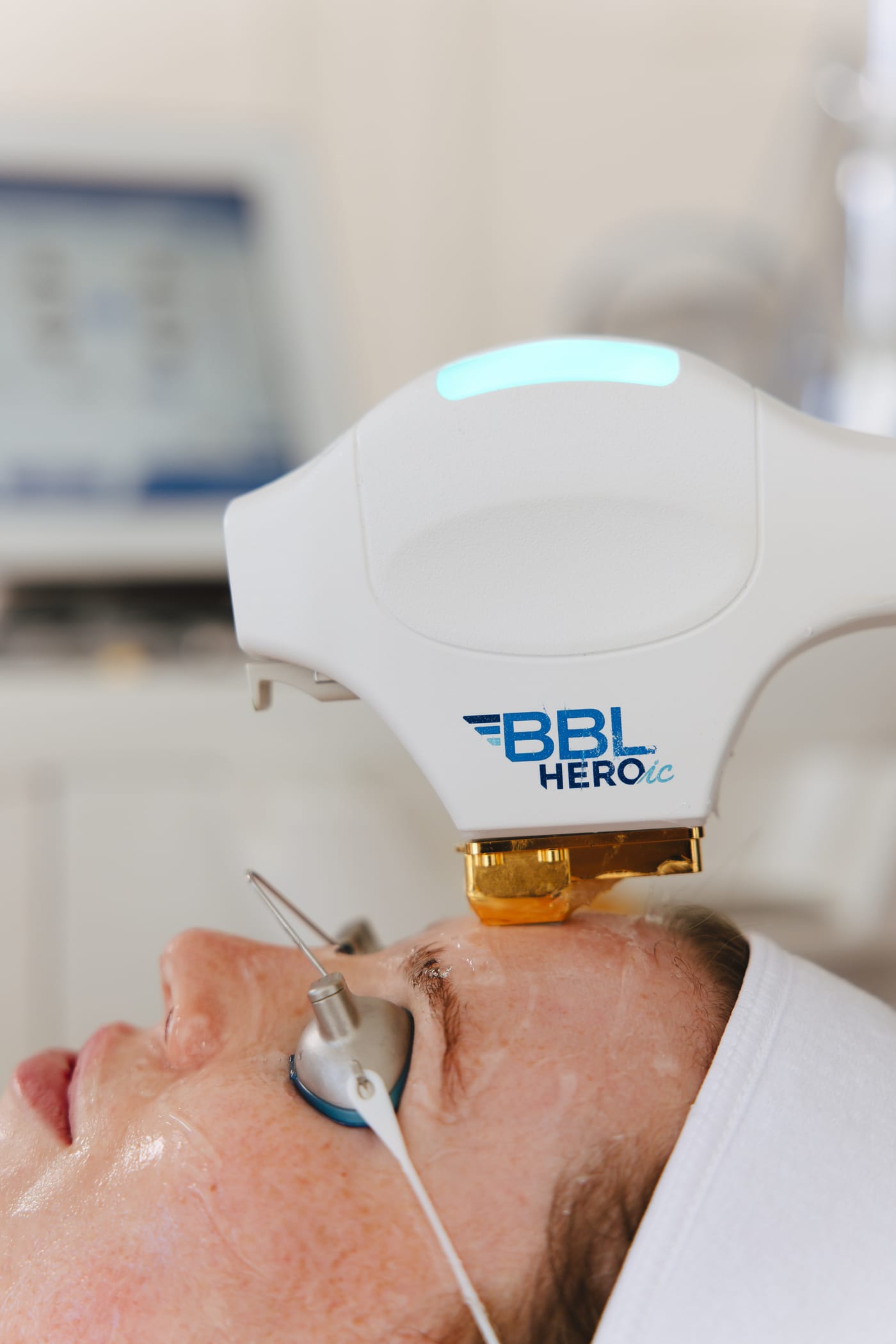 BBL HEROic handpiece with blue light — close-up