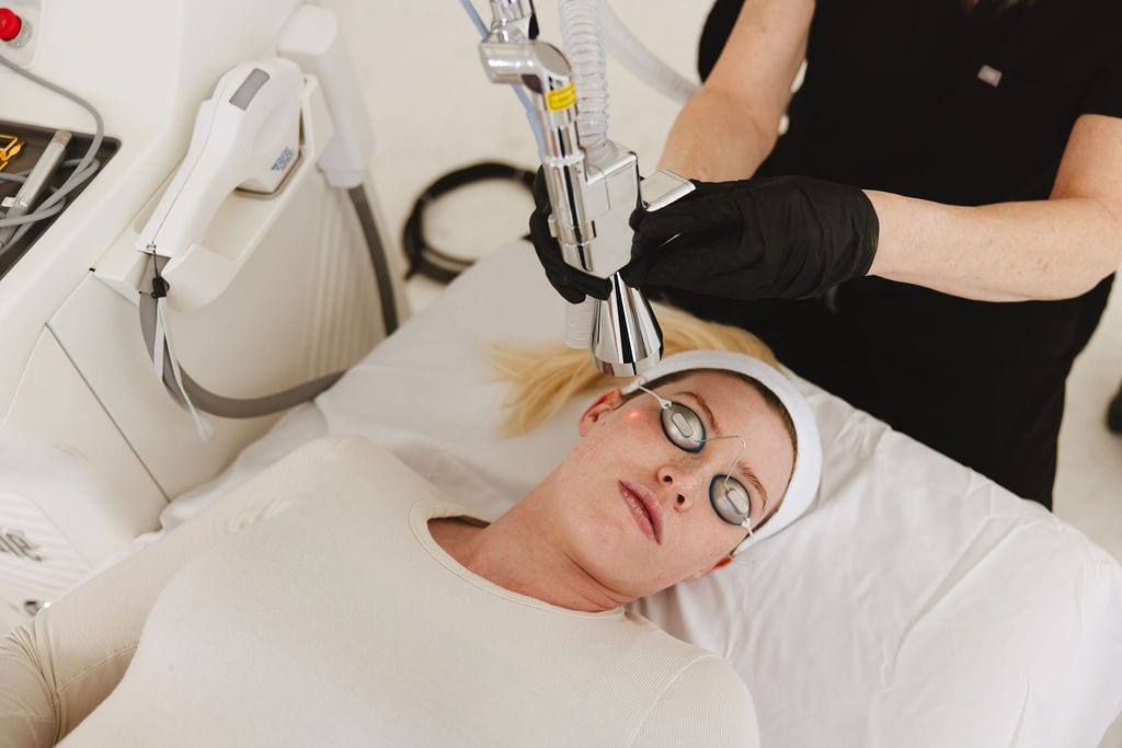 Patient after NanoLaserPeel treatment at Treasure Valley Medical Spa