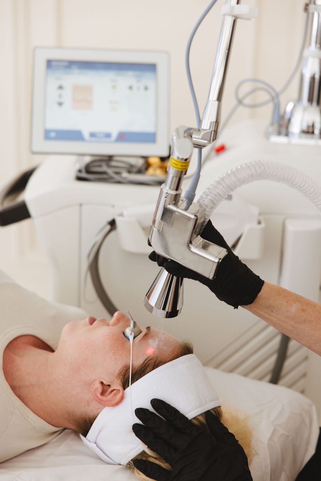 MicroLaserPeel laser skin resurfacing at Treasure Valley Medical Spa in Meridian, Idaho