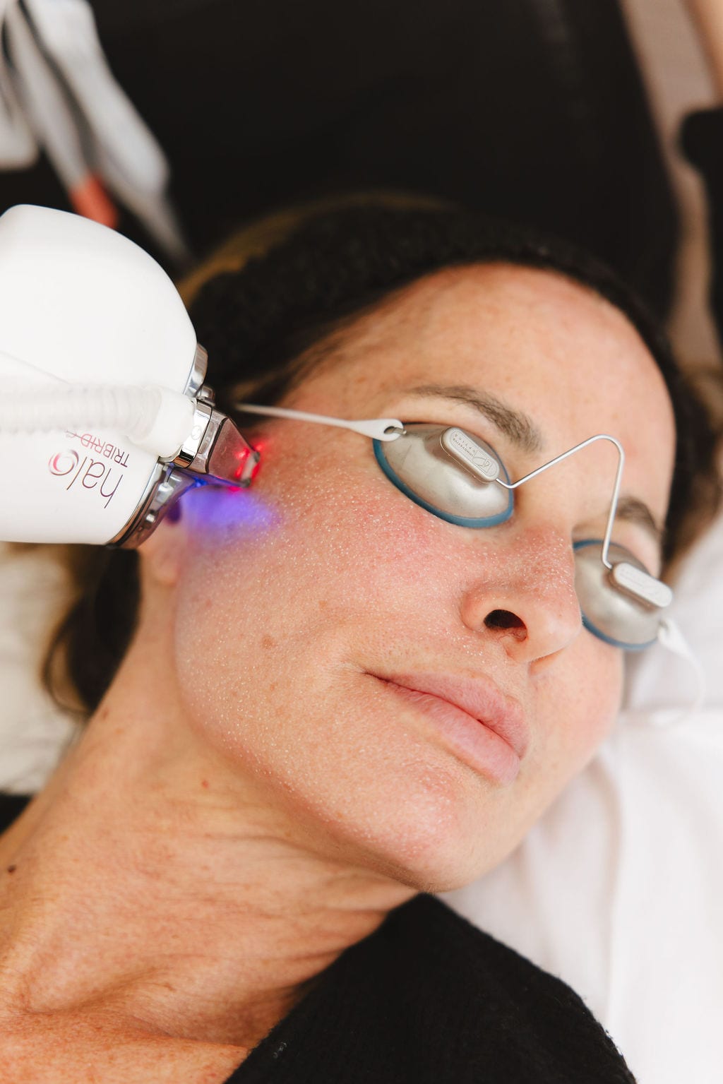Close-up of HALO TRIBRID laser light treating skin — multiple wavelengths visible