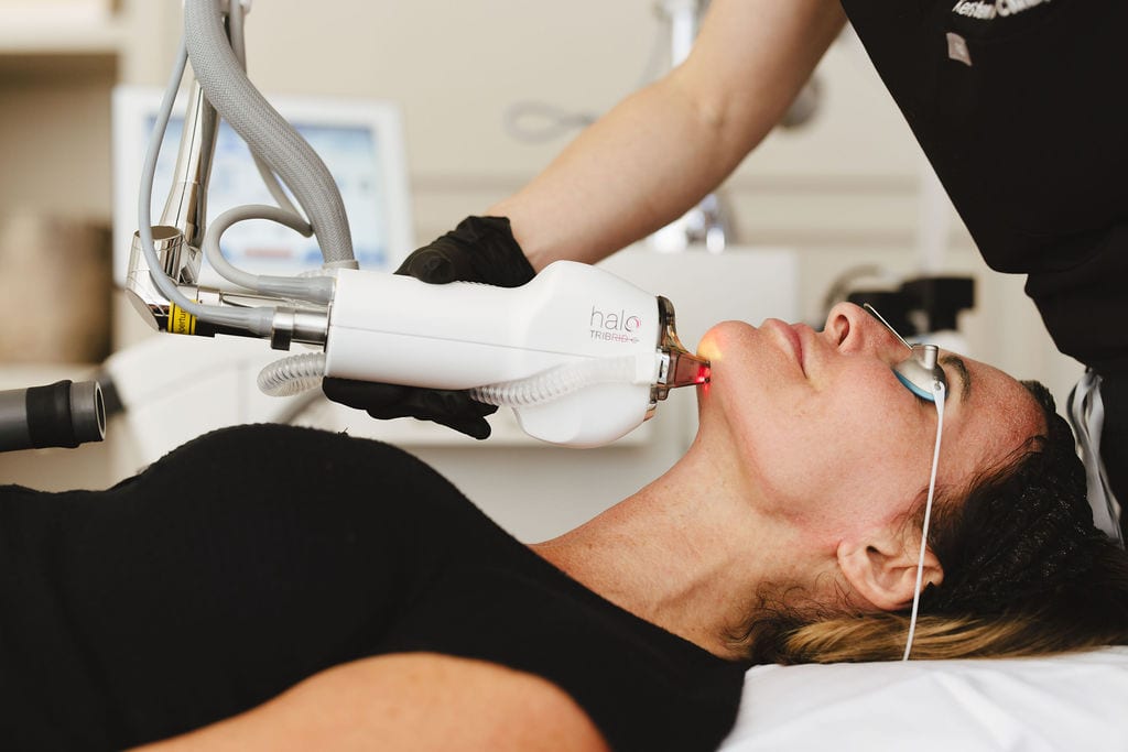 HALO TRIBRID laser treatment being performed at Treasure Valley Medical Spa in Meridian, Idaho