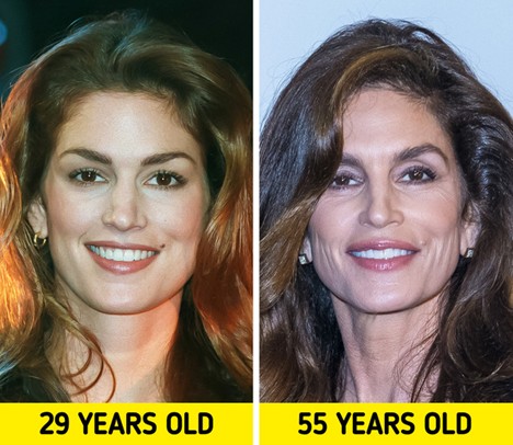 Cindy Crawford young vs older — showing upper eyelid hollowness despite excellent overall results