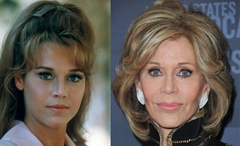 Jane Fonda young vs older — illustrating how brow position and upper eyelid fullness change with age