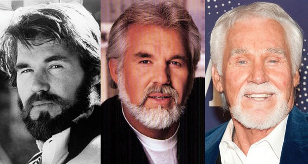 Kenny Rogers — three photos showing young, mid-life, and after poor upper eyelid surgery with unnatural hollowness